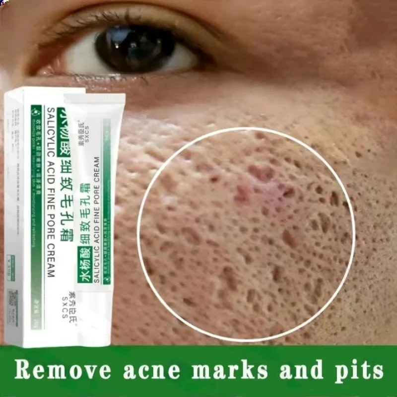Korean Lifestyle Products - Salicylsäure Poren Clearing Creme Schrumpfen Poren