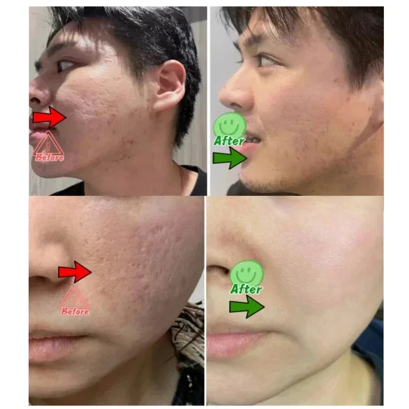 Salicylsäure Poren Clearing Cr – Korean Lifestyle Products Bewertung und Preis