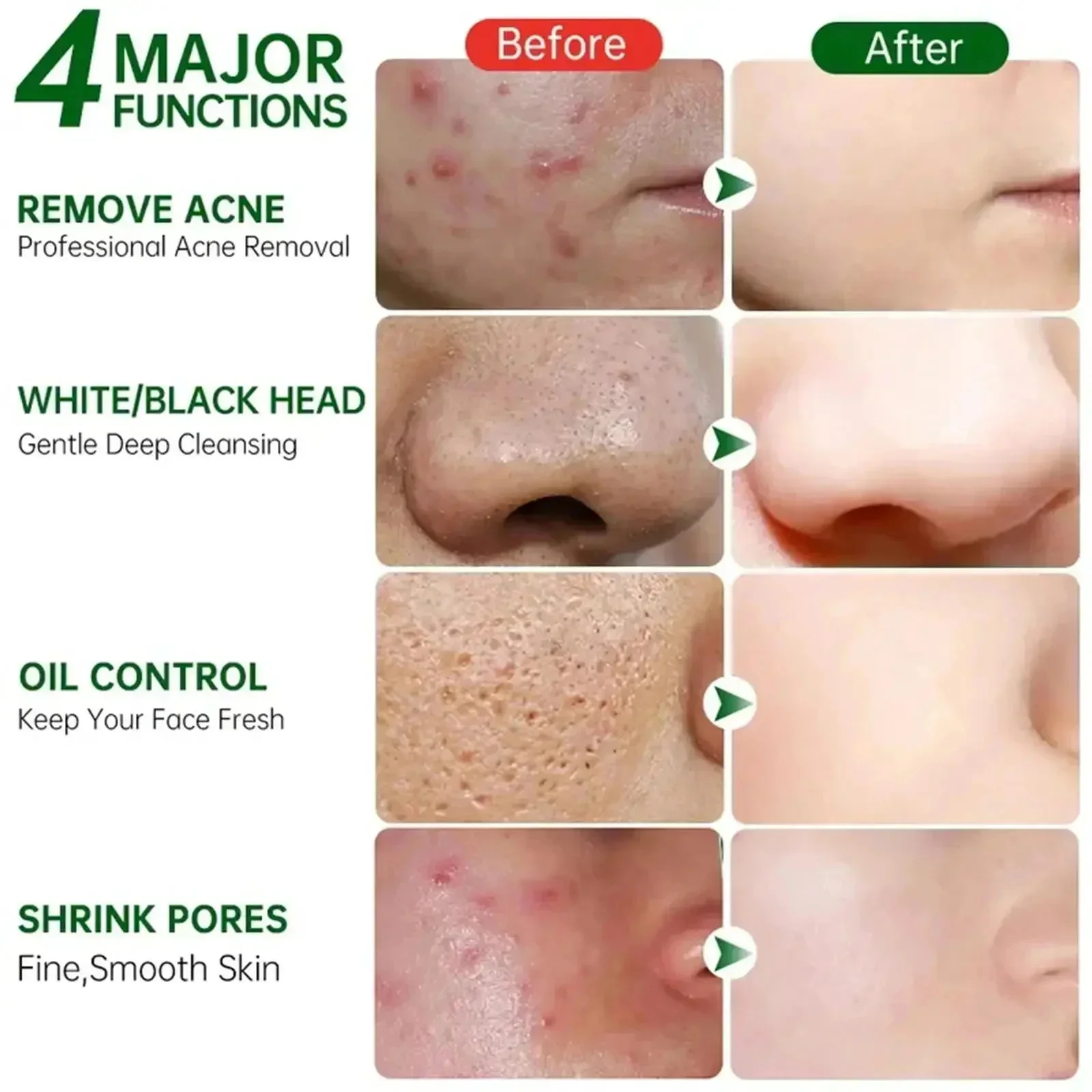 Salicylsäure Poren Clearing Cr – Korean Lifestyle Products Bewertung und Preis