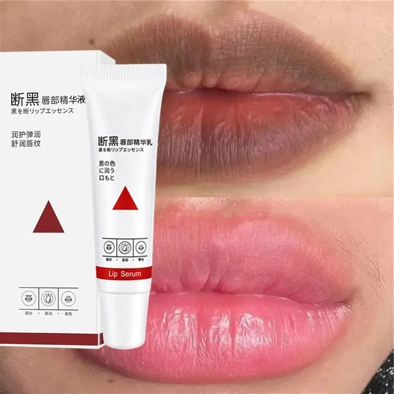 Dunkle Lippen aufhellen: Schne – Korean Lifestyle Products Bewertung und Preis