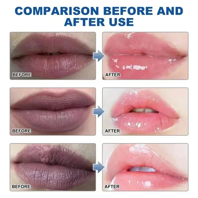 Dunkle Lippen aufhellen: Schne – Korean Lifestyle Products Bewertung und Preis