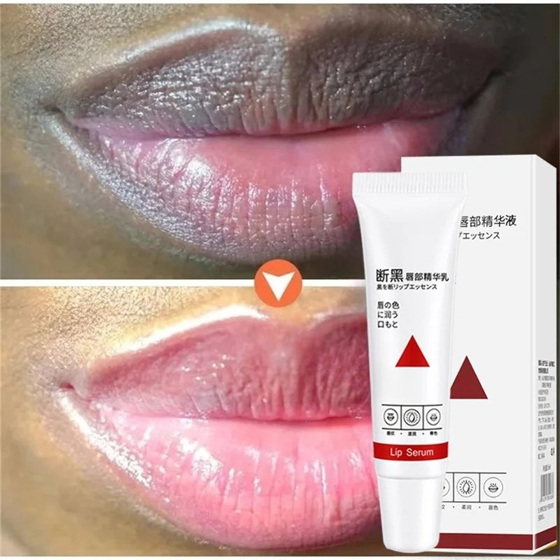 Dunkle Lippen aufhellen: Schne – Korean Lifestyle Products Bewertung und Preis