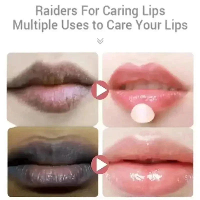 Dunkle Lippen aufhellen: Schne – Korean Lifestyle Products Bewertung und Preis