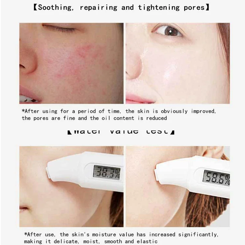 30 stücke Centella Kollagen Sc – Korean Lifestyle Products Bewertung und Preis