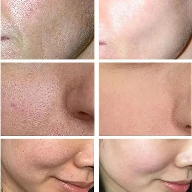 Salicylsäure Porenverengende C – Korean Lifestyle Products Bewertung und Preis
