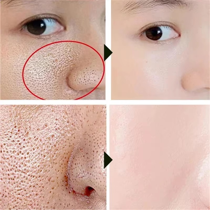 Salicylsäure Porenverengende C – Korean Lifestyle Products Bewertung und Preis
